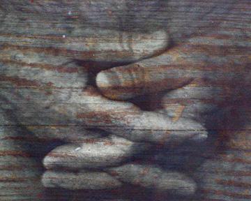 WISING UP GALLERY ILLNESS & GRACE SERIES #18