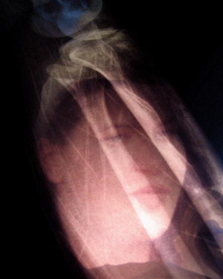 WISING UP GALLERY PATIENT SERIES #9